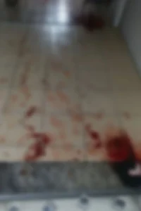 Homem fica gravemente ferido após dar soco em vidraça durante discussão, em Indaial