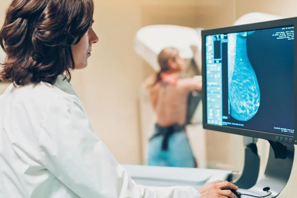 SUS amplia acesso à mamografia a mulheres de 40 a 49 anos