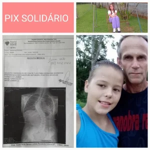 Ajude a Amandinha, de Vitor Meireles, a iniciar tratamento urgente contra escoliose severa