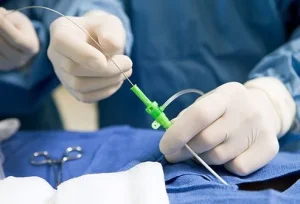 Hospital Regional Alto Vale realiza primeiro procedimento de ablação cardíaca da instituição