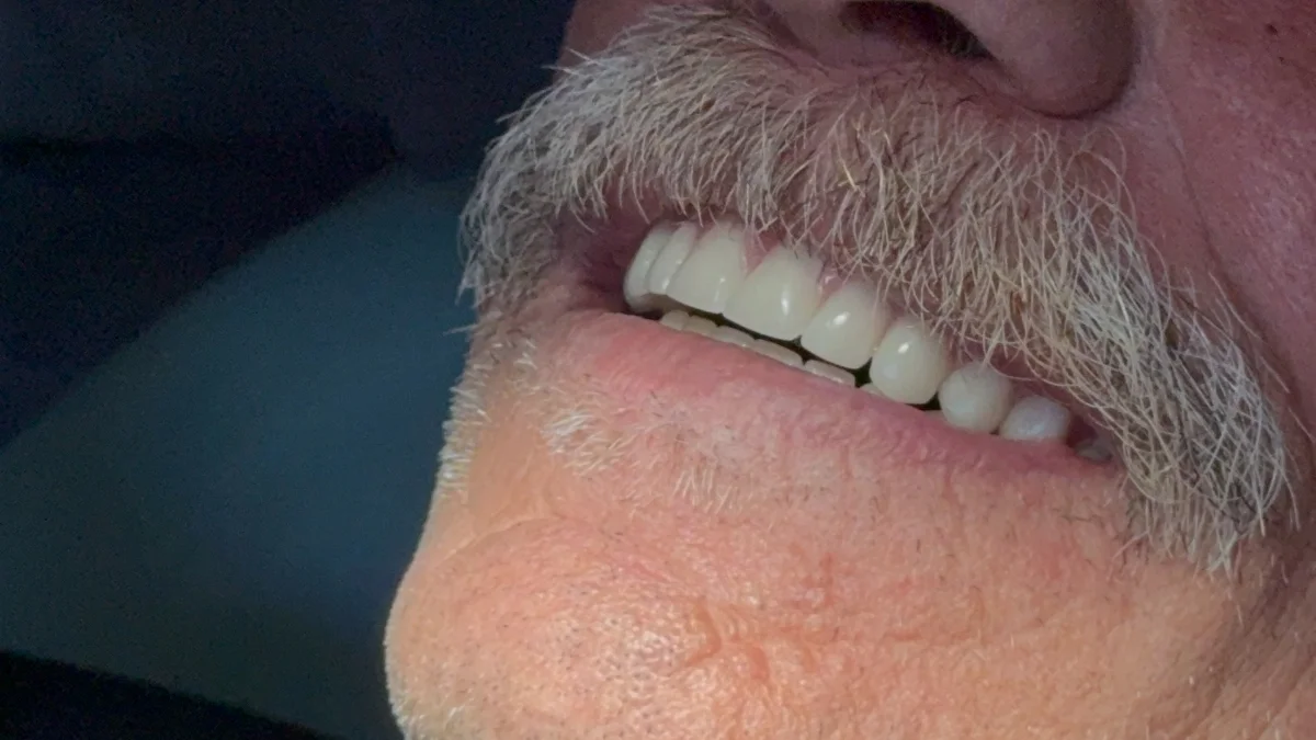 Dentaduras