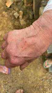 Mulher é picada por jararaca enquanto cuidava do jardim em Rio do Sul
